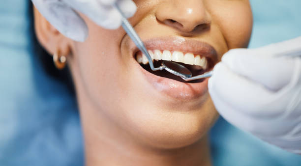 Best Emergency Wisdom Teeth Removal in Evansville, WY