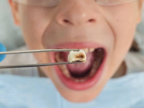 Best Emergency Broken Tooth Repair in Evansville, WY